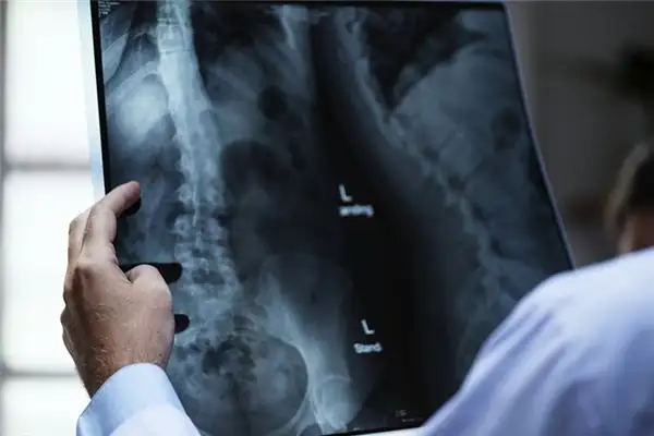 Dreaming of an Orthopedic Doctor Meaning and Interpretation - NuvoraDream