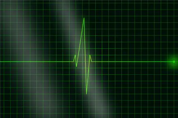 Dream Interpretation Pulse Meaning in Your Sleep - DreamDecode-DreamDecode