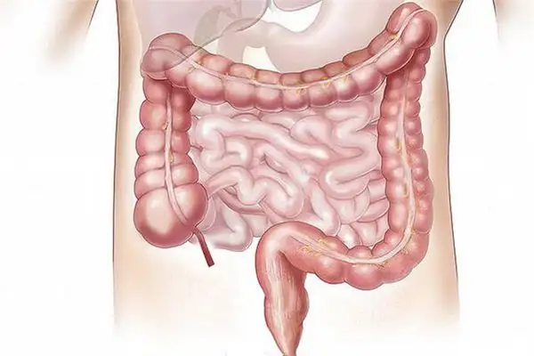 Dream of Intestines Meaning and Interpretation - NuvoraDream