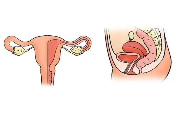 Dream Interpretation of Uterus in Dreams