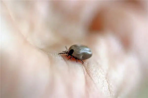 Dreaming of Parasites Meaning and Interpretation - NuvoraDream - DreamDecode-DreamDecode