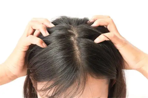 Dreaming of Lice on Someone\'s Head Meaning - NuvoraDream-DreamDecode